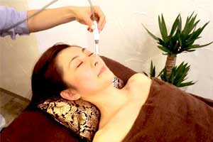 サクション吸引